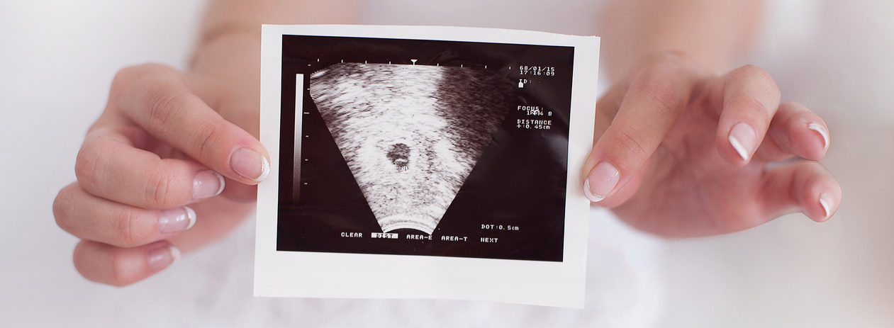 Women holding pregnancy confirmation ultrasound photo