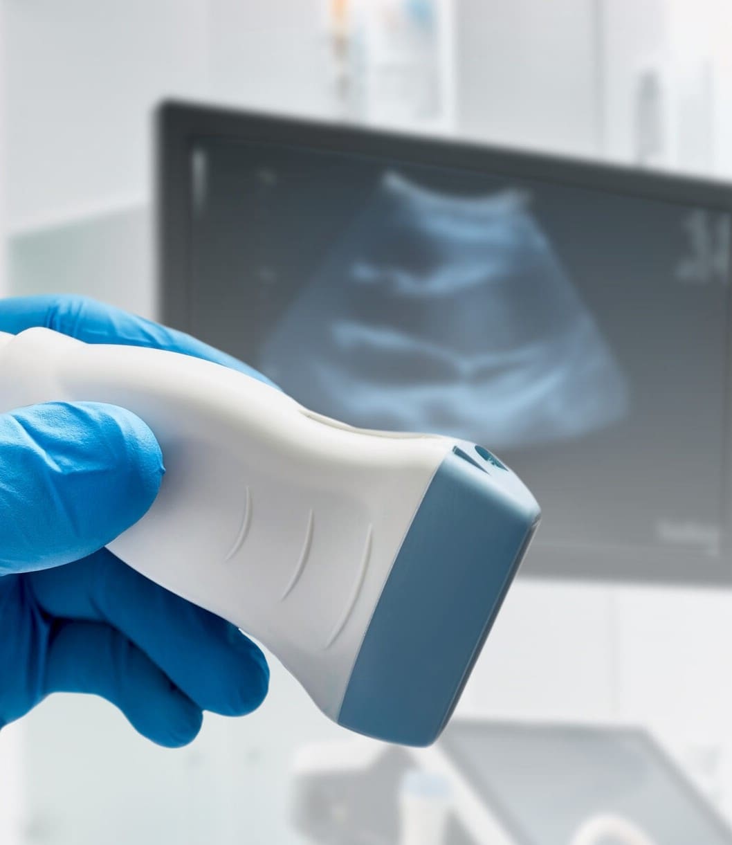 An ultrasound machine at Expectations Women's Center
